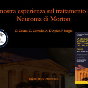 La nostra esperienza sul trattamento del Neuroma di Morton